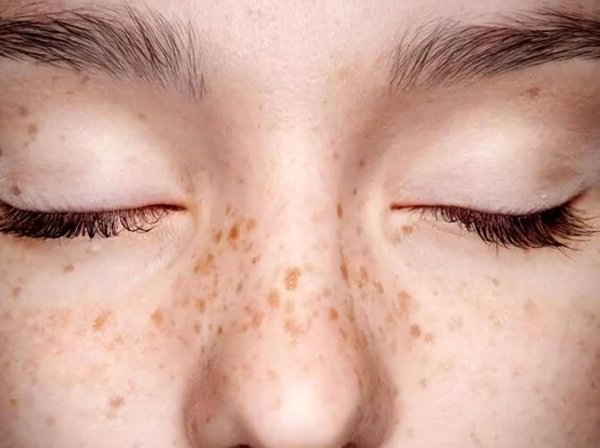 真正的破瘀高手, 不是血府逐瘀, 不是桂枝茯苓丸, 而是不起眼的它